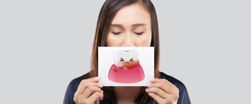 Emergency Dental Care: What to Do When a Dental Problem Can't Wait