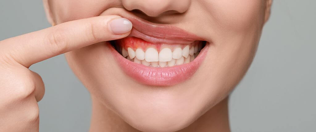 Genetic Factors in Periodontal Disease: Is Gum Health Hereditary?